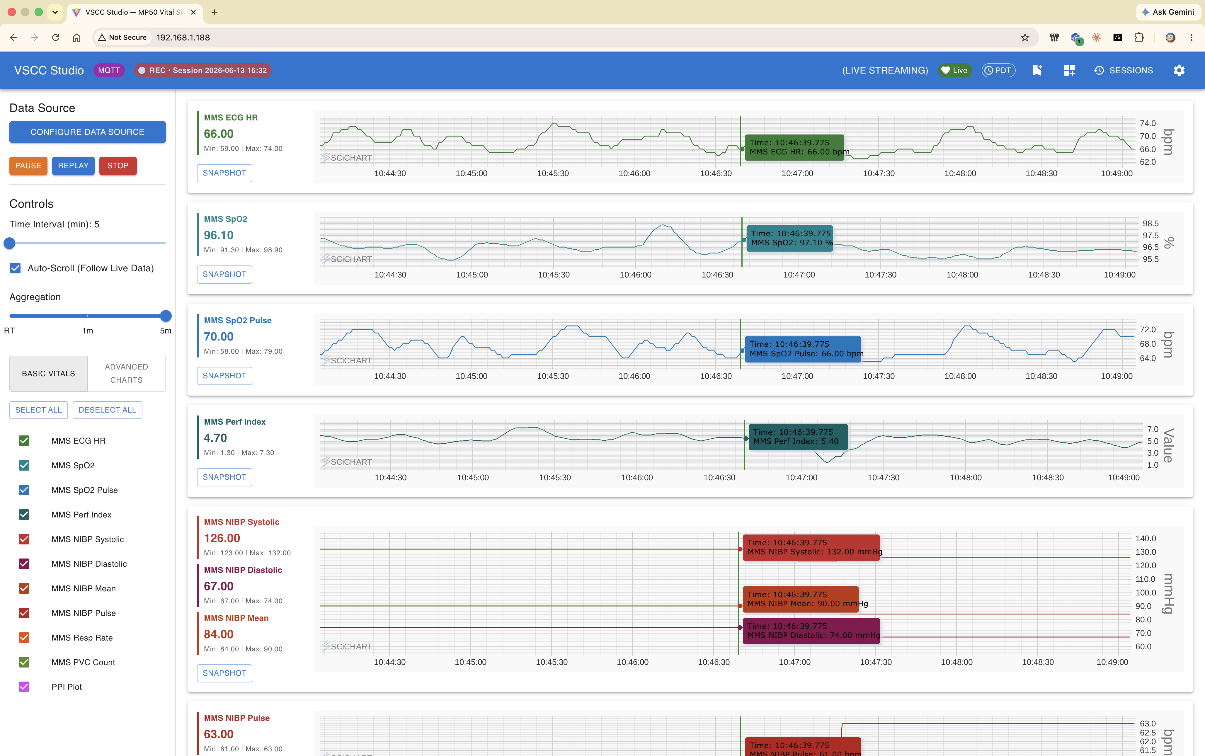 VSCC Studio dashboard showing a live-streaming toolbar, data-source controls, and multiple SciChart vital-sign trend panels.