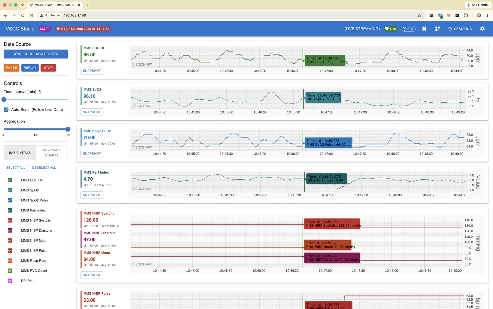 VSCC Studio dashboard showing a live-streaming toolbar, data-source controls, and multiple SciChart vital-sign trend panels.